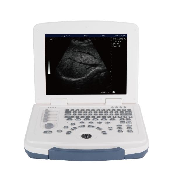 Buy BW Laptop Ultrasound Machine Full Digital Ultrasound Scanner GH580 at wholesale prices