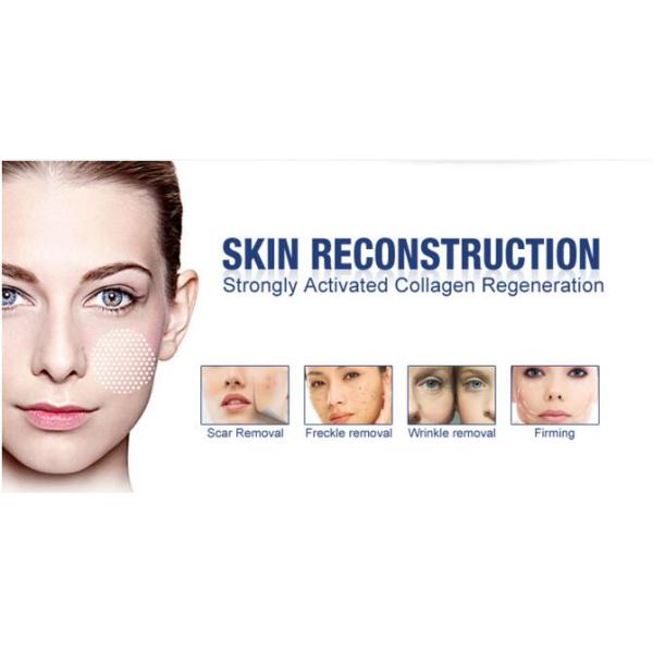 10600nm Ultra Pulse Co2 Fractional Laser  Tightening Device With Wind Cooling