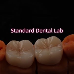 Full Contour Bruxier Monolithic Zirconia Crown Bridge Dental Lab