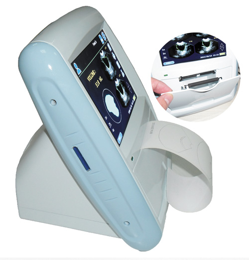 Buy Ultrasound bladder scanner Bladder volume ultrasound scanner at wholesale prices