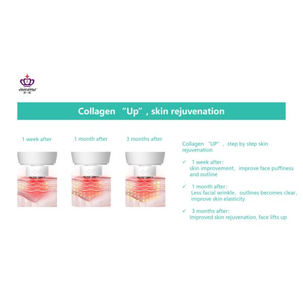 Ultrasonic Slimming Skin Tightening RF Beauty Instrument