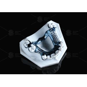 Hypoallergenic Adjustable And Customizable 3D Printed Titanium Framework With