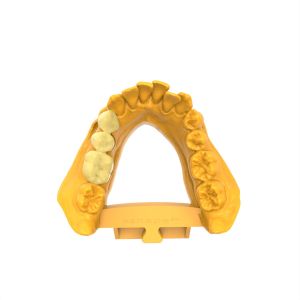 Biocompatible Permanent Crown Bridge Resin Hot Deformation Temperature 80C