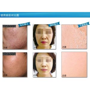 Good homemade natural Collagen Crystal Facial Masks