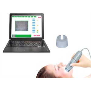 Smart Video Dermatoscope Facial Skin Camera Moisture HD Intelligent Skin