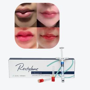 Quality Juvederm Cross Linked Injectable Dermal Filler For Lips for sale