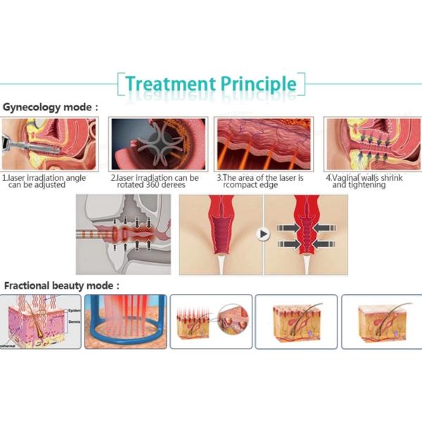 50W Skin Resurfacing CO2 Fractional Laser Machine Fractional Photothermolysis Theory