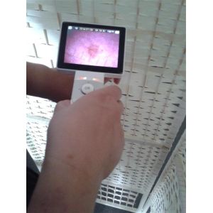 1920x1080 Digital Video Dermatoscope