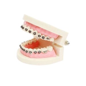 Porcelain Dental Crown Acid And Alkali Resistance Good Biocompatibility