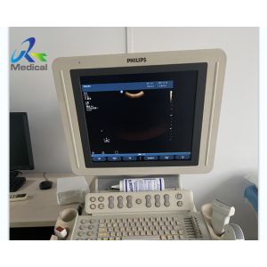 HD11 Image Blurred Image Anomaly Ultrasound Machine Repair Monitor