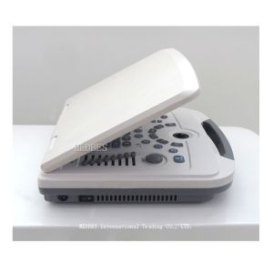 Clinic 80 elements Laptop Ultrasound Machine B580 with Battery