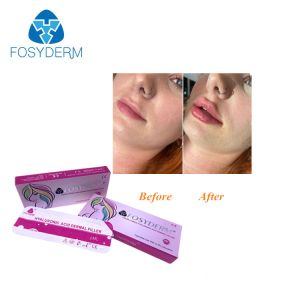 Quality Hyaluronic Acid Dermal Injectable Filler For Nose Face for sale