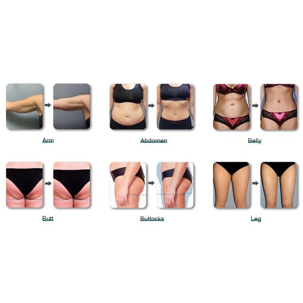 product-1200-675 Portable Ems Sculpt Slimming Machine Electric Muscle Stimulator EMS Body Shaping Sculpting Fat Burning Machine