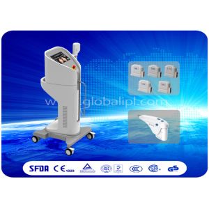 HIFU HIgh Intensity Focused Ultrasound Face Lifting Machine Body Lifting