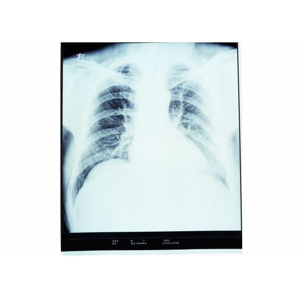 Buy High Sharpness Medical Diagnostic Imaging , Dry AGFA X Ray Film at wholesale prices