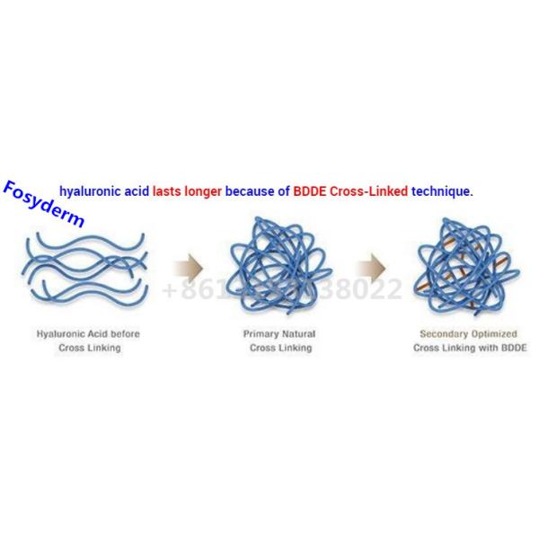 1ml Cross Linked Hyaluronic Acid Dermal Filler Injection Deep For Nose Chin Cheek