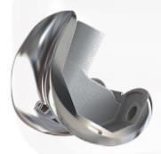 RSK PS Femoral Condyle Revision Knee Joint Prosthesis Replacement