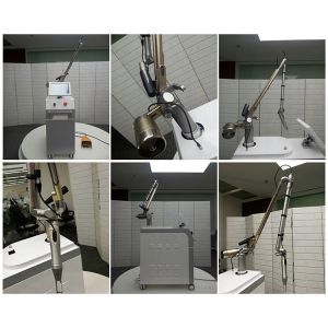 China Best Buy Cheap Price Q Switched Nd Yag Laser Tattoo Removal For Skin