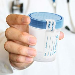 Disposable Specimen Cups| High-Grade Silicone, Sterile, Individually Wrapped