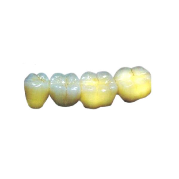 Buy Wear Resistant PFM Dental Crown High Strength Aesthetic Allergy Friendly at wholesale prices