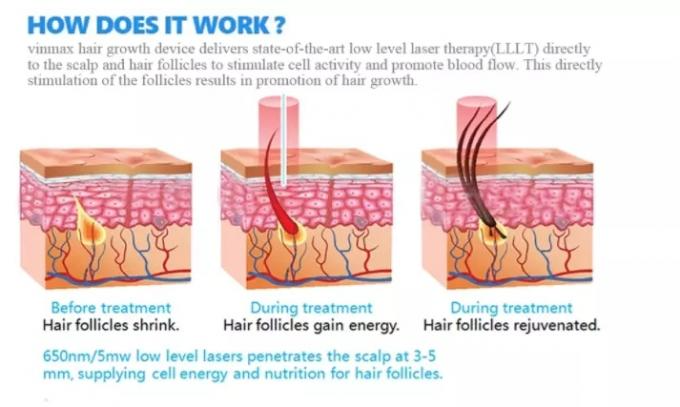 LLLT Laser Thicker Hair Growth 680nm Red Light Therapy Hair Regrowth Helmet