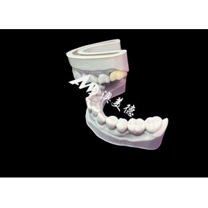 Precise Fit Zirconia Dental Crown Aesthetic Natural Colour Excellent Biocompatib