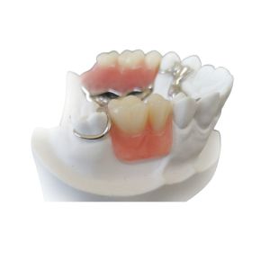 China Custom Smooth Surface CAD CAM PFM Crown Bridge High Definition on sale