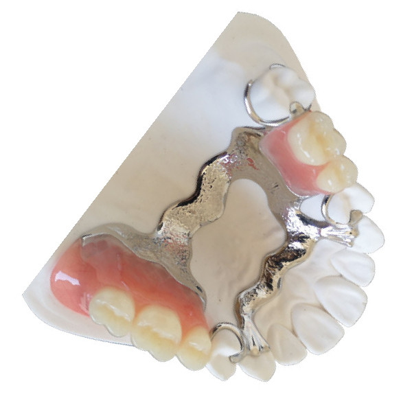 Buy Customized PFM Tooth Crown 3D Printing PFM Dental Bridge at wholesale prices
