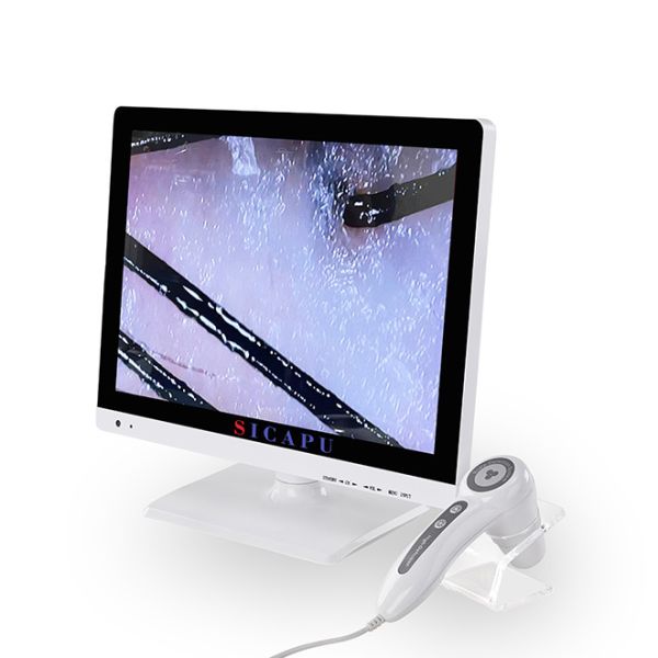 Handheld HD Hair Analyzer Machine Hair Follicle Growth Treatment For Salon