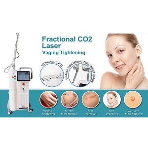 10 Inch Big Screen Skin Rejuvenation Stretch Mark Removal Vaginal Tightening