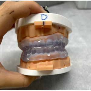 Buy cheap Customizable 3D Printed Dentures Try In Digital Complete Denture from wholesalers