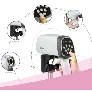 EDAN C3A&C6A Video Colposcope