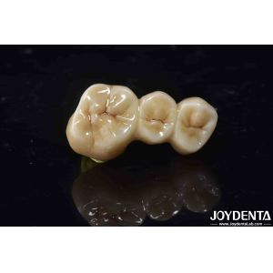 High Biocompatibility Zirconia Full Contour Crown Perfect Fit High Strength