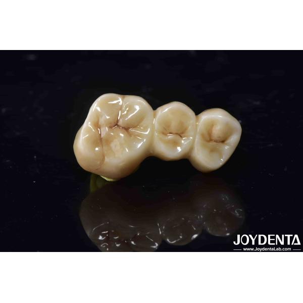 Buy High Biocompatibility Zirconia Full Contour Crown Perfect Fit High Strength at wholesale prices