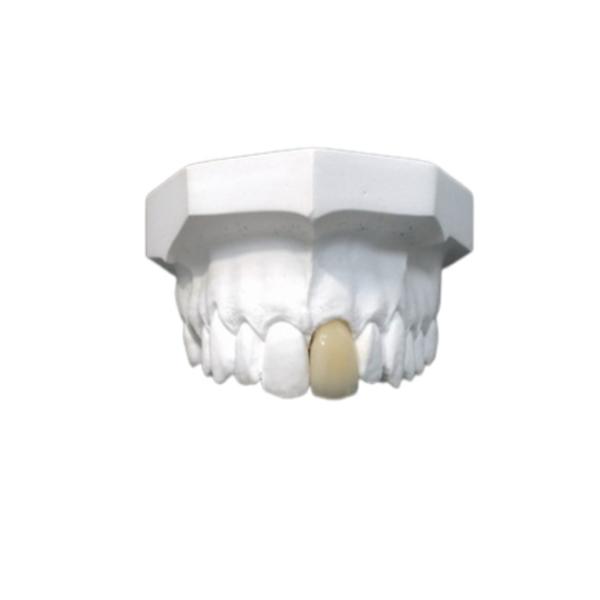 Buy Good Biocompatibility Porcelain Dental Crown High Tech Biological Material at wholesale prices