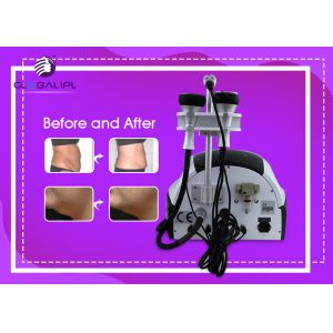 1-10 adjustable RF Cavitation Slimming Machine