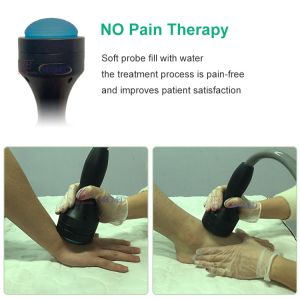 180hz Frequency Shockwave Therapy Machine Effective Treatment For Erectile