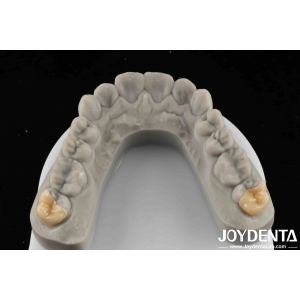 High Strength Emax Good Transparency Emax Inlay Onlay For Transparent Performanc