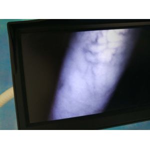 Blood Testing Equipments Infrared Veinviewer For Hospital Use