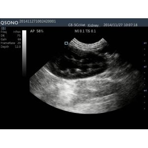 Full Digital Color Doppler Machine System Angle Adjustable Ultrasound Scanner