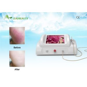 New Technology Rbs Vascular Removal / Spider Veins Removal Rbs Vascular