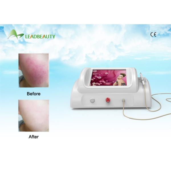 Buy New Technology Rbs Vascular Removal / Spider Veins Removal Rbs Vascular at wholesale prices