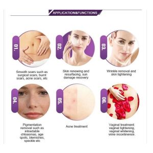 Lasertell Odm Co2 Fractional Laser Machine 10.4 Inch Screen