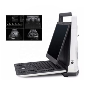 Quality High Quality Ultrasonic SonoScape E2 with Ultrasonic Sensors for sale