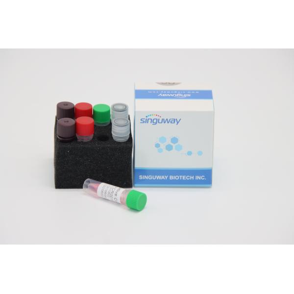 Fluorescent Real Time HCV RT PCR Kit HSV2 Test Kit Laboratory Use CE