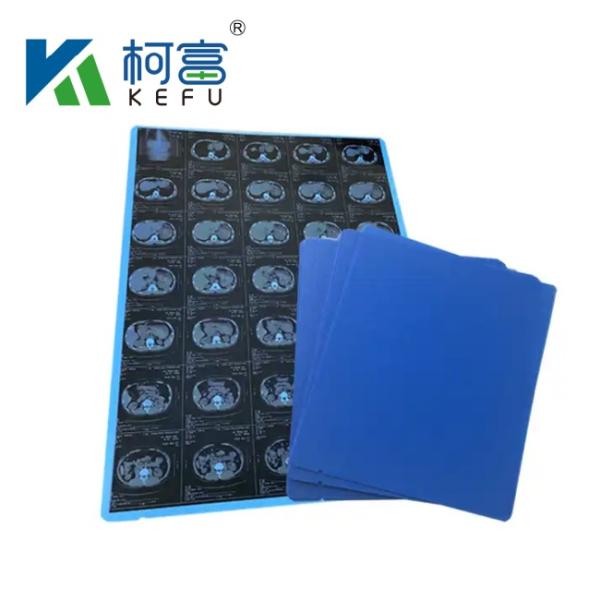 14"*17" High Quality X Ray Film Medical Blue Dry Thermal Film For Hospital Medial Devices