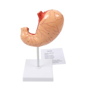 Anatomy Human Organs Gastric Diseased Dissection Stomach Teaching Model