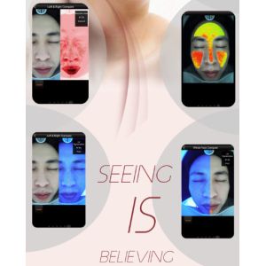 Accurately Analysis Facial Skin Analyzer For Doctors Clinic Salon