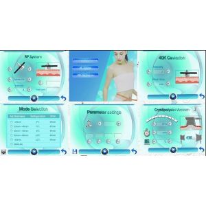 Liposuction Cryolipolysis Slimming Machine / Zeltiq CoolSculpting Slimming