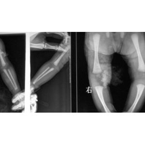 10 x 14inch Dry Medical X Ray Films For Fuji 3000 / 2000 / 1000